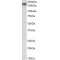 NPC Intracellular Cholesterol Transporter 1 (NPC1) Antibody