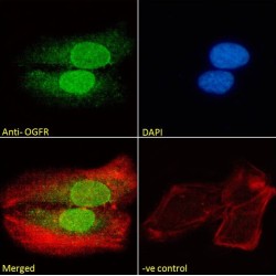 Opioid Growth Factor Receptor (OGFR) Antibody