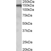 abx433071 (0.1 µg/ml) staining of Human Amygdala lysate (35 µg protein in RIPA buffer). Primary incubation was 1 hour. Detected by chemiluminescence.