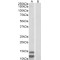 p15INK4b (Isoform 2) Antibody