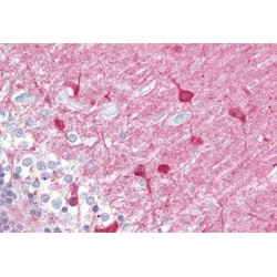 Protein Kinase C And Casein Kinase Substrate In Neurons Protein 1 (PACSIN1) Antibody