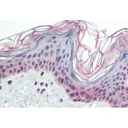 Poly ADP-Ribose Polymerase 2 (PARP2) Antibody