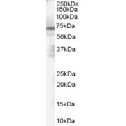 abx433093 (1 µg/ml) staining of Human Spleen Lysate (35 µg protein in RIPA buffer). Primary incubation was 1 hour. Detected by chemiluminescence.