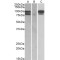 Proprotein Convertase Subtilisin/Kexin Type 9 (PCSK9) Antibody