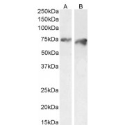 abx433104 (2 µg/ml) staining of HeLa (A) and (1 µg/ml) of HepG2 (B) cell lysate (35 µg protein in RIPA buffer). Detected by chemiluminescence.