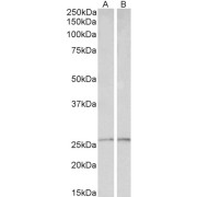 abx433117 (0.1 µg/ml) staining of Liver (A) and Heart (B) lysates (35 µg protein in RIPA buffer). Primary incubation was 1 hour. Detected by chemiluminescence.