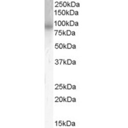 Phosphodiesterase 4B Antibody