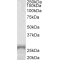 Paired Like Homeobox 2a (PHOX2A) Antibody