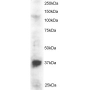 abx433135 staining (2 µg/ml) of Jurkat lysate (RIPA buffer, 30 µg total protein per lane). Primary incubated for 1 hour. Detected by western blot using chemiluminescence.