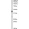 PIN2/TERF1 Interacting, Telomerase Inhibitor 1 (PINX1) Antibody