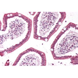 Phospholipase A2, Group IIA (PLA2G2A) Antibody