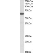 abx433141 (0.03 µg/ml) staining of Human Pancreas lysate (35 µg protein in RIPA buffer). Primary incubation was 1 hour. Detected by chemiluminescence.