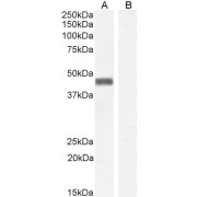 abx433144 staining (0.05 µg/ml) of Human PBMC lysate (RIPA buffer, 35 µg total protein per lane). Detected by chemiluminescence.