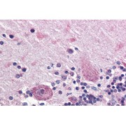 abx433167 (5 µg/ml staining of paraffin embedded Human Cerebellum. Steamed antigen retrieval with citrate buffer pH 6, AP-staining.