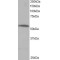 Protein Phosphatase 2 Regulatory Subunit B'Alpha (PPP2R5A) Antibody