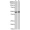 Protein Kinase, cAMP Dependent Catalytic Alpha (PRKACA) Antibody