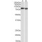 Protein Kinase C Beta (PRKCB) Antibody