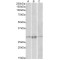 Paired Mesoderm Homeobox Protein 1 (PRRX1) Antibody