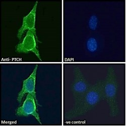 Protein Patched Homolog 1 (PTCH) Antibody