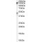 Protein Patched Homolog 1 (PTCH) Antibody