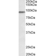 abx433196 (0.3 µg/ml) staining of Human Testis lysate (35 µg protein in RIPA buffer). Primary incubation was 1 hour. Detected by chemiluminescence.