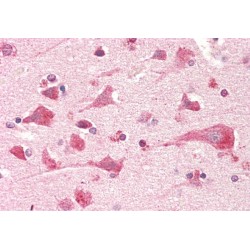 Prostaglandin E Synthase 2 (PTGES2) Antibody