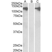 HEK293 lysate (10 µg protein in RIPA buffer) overexpressing Human PUM2 with DYKDDDDK tag probed with abx433206 (0.5 µg/ml) in Lane A and probed with anti- DYKDDDDK Tag (1/3000) in lane C. Mock-transfected HEK293 probed with abx433206 (1mg/ml) in Lane B. Primary incubations were for 1 hour. Detected by chemiluminescence.