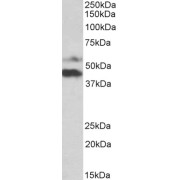 abx433207 (1 µg/ml) staining of Human Colorectal Cancer lysate (35 µg protein in RIPA buffer). Detected by chemiluminescence.