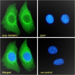 Ran-Binding Protein 1 (RANBP1) Antibody