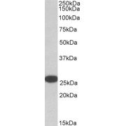 abx433214 (0.05 µg/ml) staining of HeLa lysate (35 µg protein in RIPA buffer). Detected by chemiluminescence.