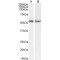 Retinoic Acid Receptor Alpha (RARA) Antibody