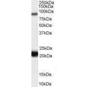 abx433216 (0.3 µg/ml) staining of Human Thyroid lysate (35 µg protein in RIPA buffer). Primary incubation was 1 hour. Detected by chemiluminescence.