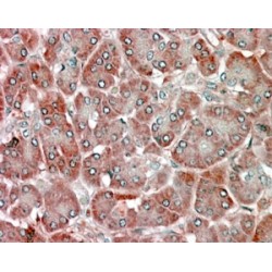 Retinol-Binding Protein 1 (RBP1) Antibody