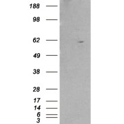 HEK293 overexpressing RXRB and probed with abx433242 (mock transfection in first lane).