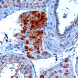 SBP2 Antibody