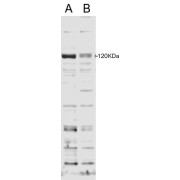 abx433250 staining of HFF cell lysate with B) 100nM siRNA or A) control siRNA. Detected by chemiluminescence. Data kindly provided by Laura Papp and Kum Kum Khanna, Brisbane, Australia.