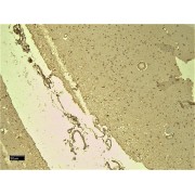 IHC-P analysis of paraffin embedded Human Cortex tissue using SCN5A antibody (8 µg/ml).