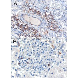 SH3 Domain Binding Protein 1 (SH3BP1) Antibody