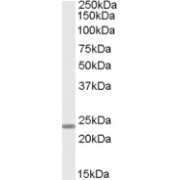 abx433305 (0.1 µg/ml) staining of Human Muscle lysate (35 µg protein in RIPA buffer). Primary incubation was 1 hour. Detected by chemiluminescence.