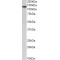 Sp140 Nuclear Body Protein (SP140) Antibody