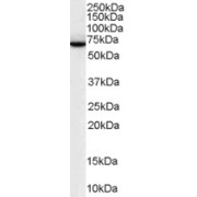 abx433332 (0.1 µg/ml) staining of Human Lymph Node lysate (35 µg protein in RIPA buffer). Detected by chemiluminescence.