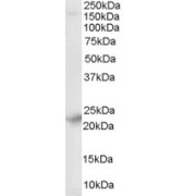 abx433334 (0.01 µg/ml) staining of Human Brain lysate (35 µg protein in RIPA buffer). Primary incubation was 1 hour. Detected by chemiluminescence.