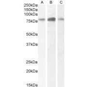 Western blot analysis of extract of LNCaP (A), A431 (B) and nuclear (C) cell lysate (35 µg protein in RIPA buffer) using TBK1 antibody ((A and B): 0.5 µg/ml, (C): 1 µg/ml).