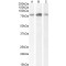 Serine/threonine-Protein Kinase TBK1 (TBK1) Antibody