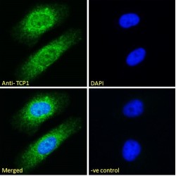 T-Complex 1 (TCP1) Antibody