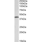 abx433367 (2 µg/ml) staining of Human Colorectal Cancer lysate (35 µg protein in RIPA buffer). Detected by chemiluminescence.