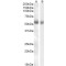 Transmembrane Protease, Serine 2 (TMPRSS2) Antibody