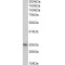 Troponin I, Slow Skeletal Muscle (TNNI1) Antibody