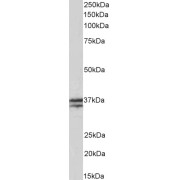 abx433390 (0.03 µg/ml) staining of Human Skeletal Muscle lysate (35 µg protein in RIPA buffer). Primary incubation was 1 hour. Detected by chemiluminescence.
