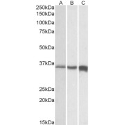 Biotinylated abx431679 (0.01 µg/ml) staining of Human (A), Mouse (B) and Rat (C) Skeletal Muscle lysates (35 µg protein in RIPA buffer). Primary incubation was 1 hour. Detected by chemiluminescence.